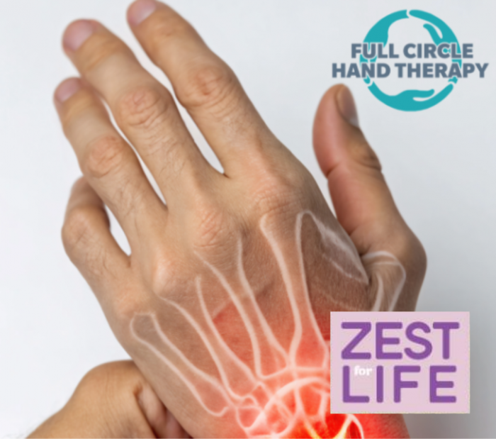Image for Hand Arthritis